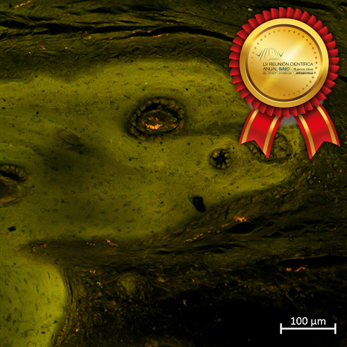 500-Tucumbonesaurium-Liliana-Missana
